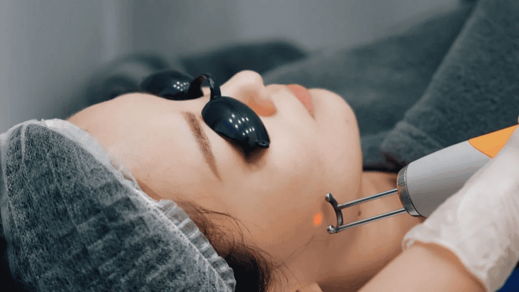 ATASI MELASMA DENGAN PICO BLACK SHOOT: TEKNOLOGI TERBARU UNTUK KULIT BEBAS NODA