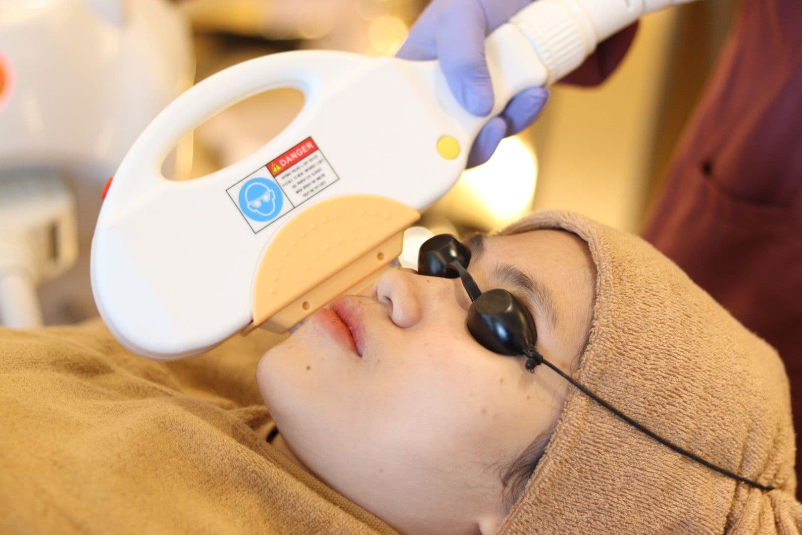 ATASI FLEK HITAM DENGAN DPL VASCULAR THERAPY, AMAN DAN EFEKTIF!